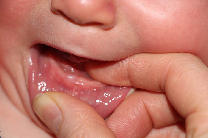 diş çıkarmakta olan bir bebeğin diş eti