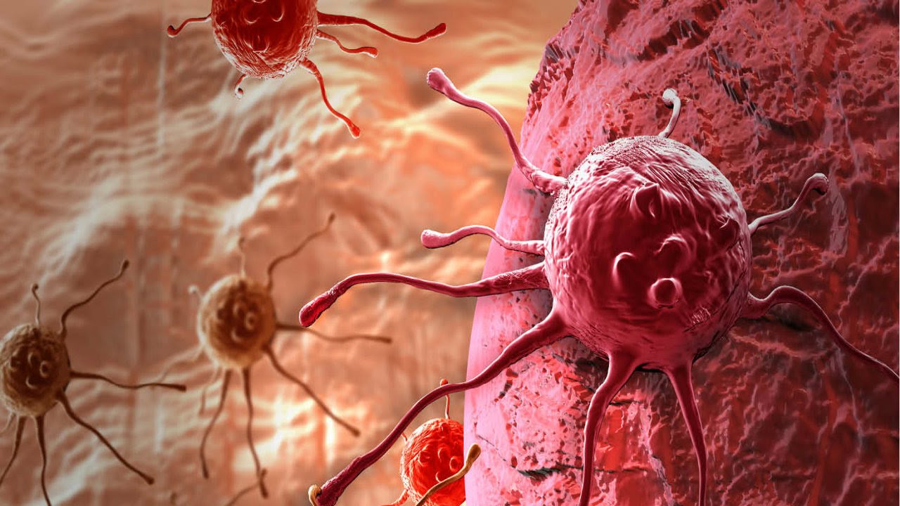 Ferritin Düşüklüğü Nelere Sebep Olur, Saç Dökülmesi Yapar mı Ferritin Düşüklüğü Nelere Sebep Olur, Saç Dökülmesi Yapar mı